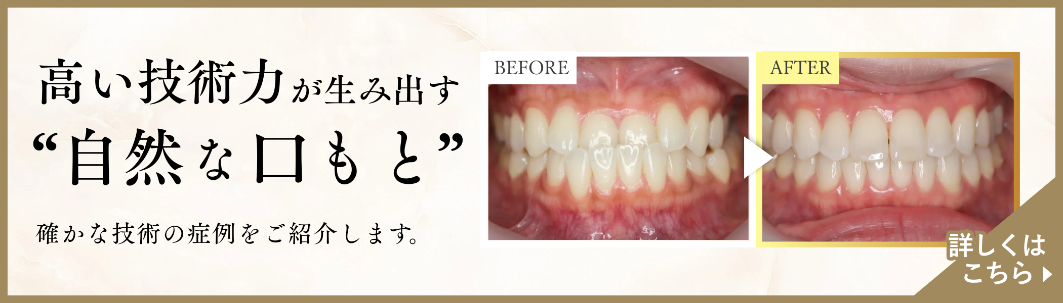 確かな技術の症例をご紹介します