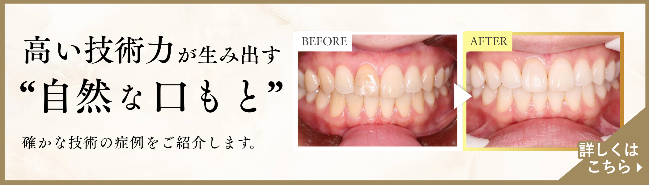 確かな技術の症例をご紹介します